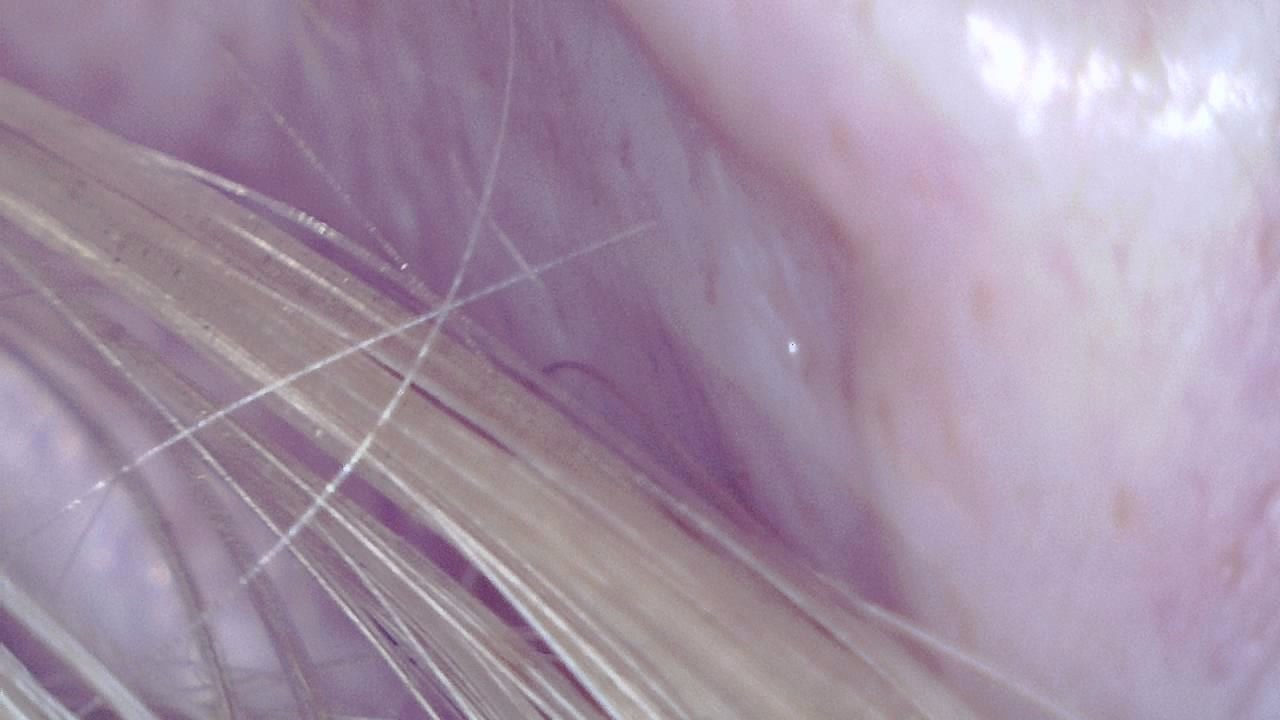 Veterinary Dermatology microscopy sample image 1