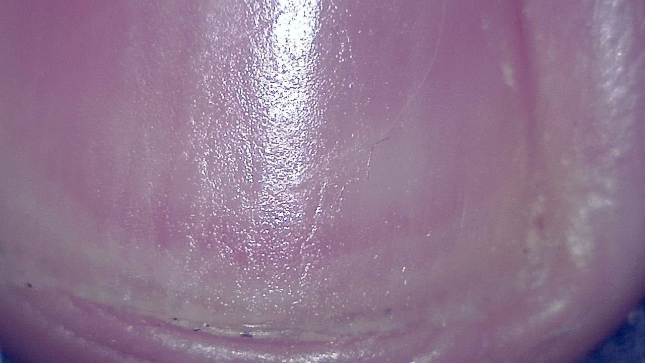Podiatry microscopy sample image 6