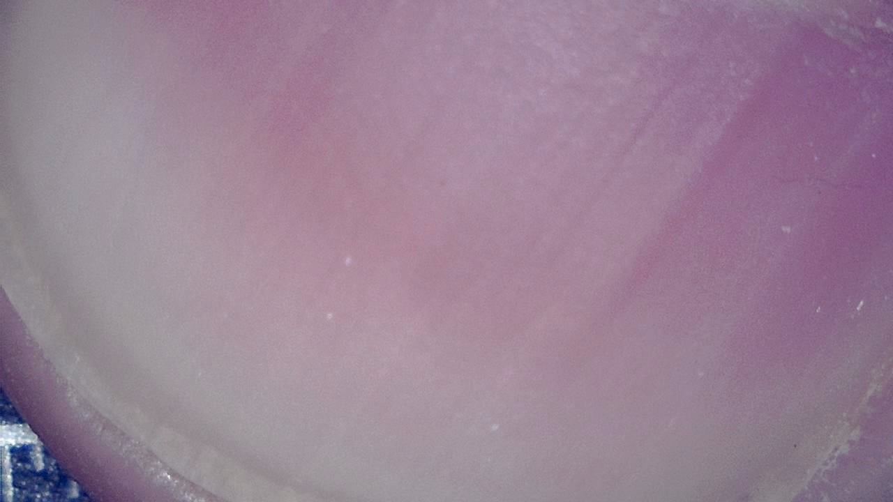 Podiatry microscopy sample image 8