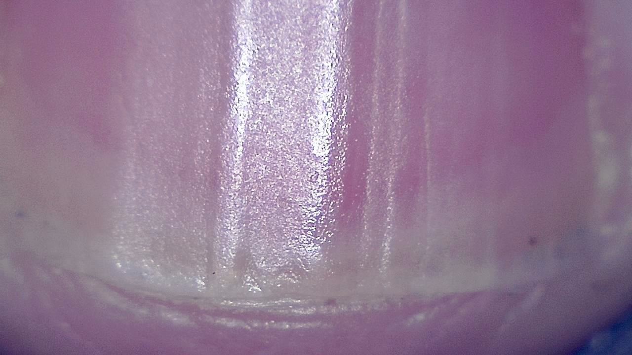 Podiatry microscopy sample image 11