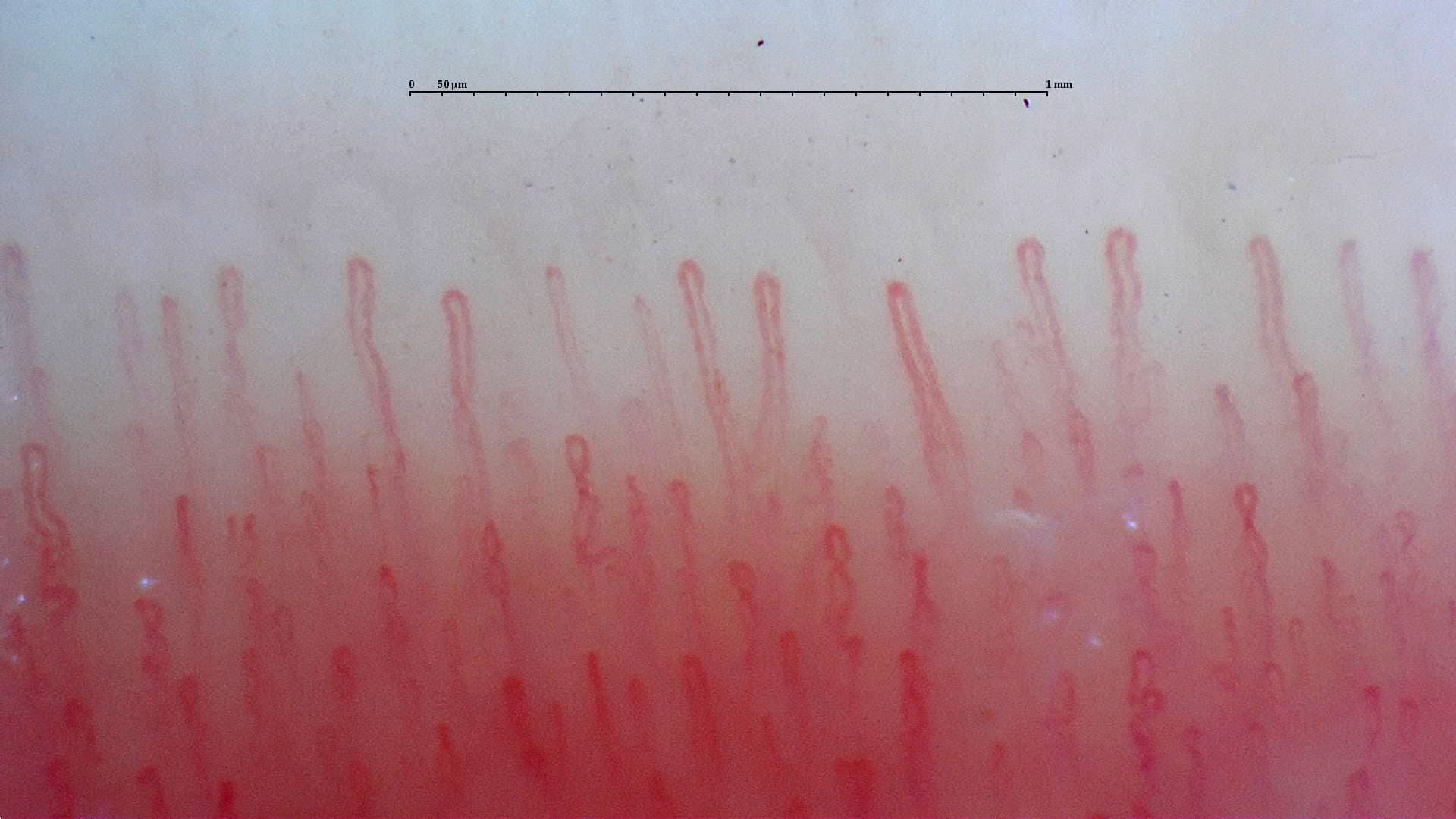 Nailfold Capillaroscopy microscopy sample image 3