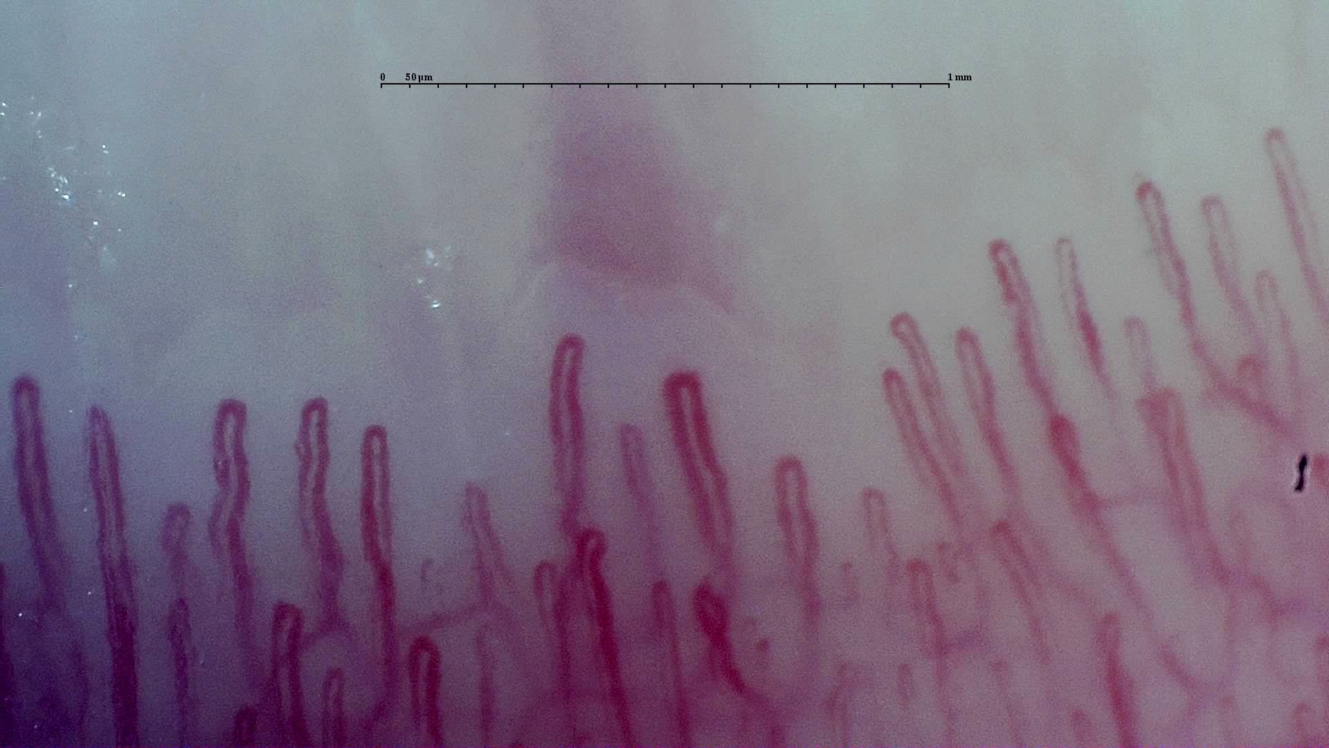 Nailfold Capillaroscopy microscopy sample image 5
