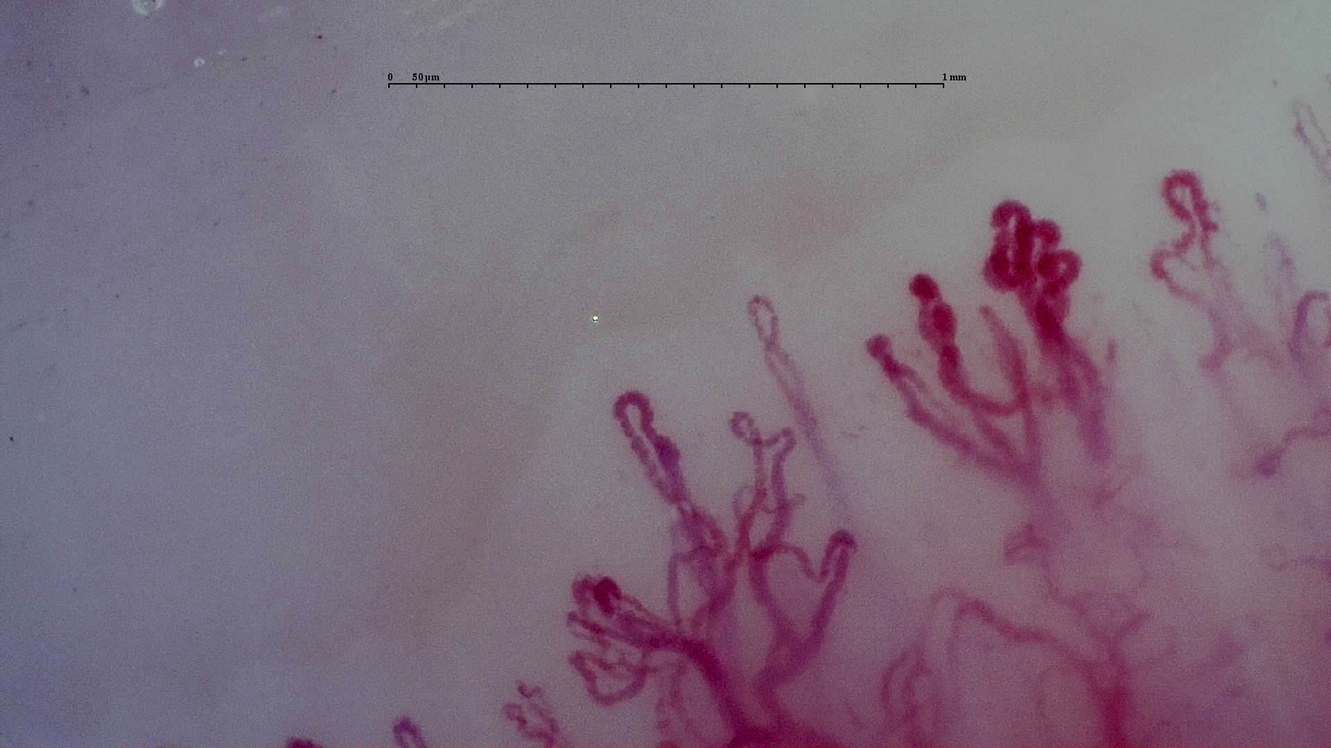 Nailfold Capillaroscopy microscopy sample image 6